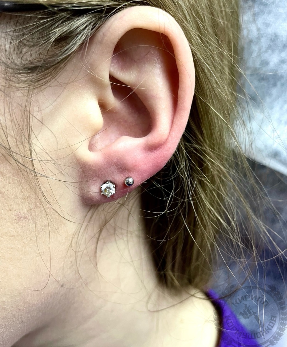 Двойной прокол мочки